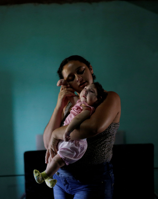 a mother holds a baby with microcephaly in brazil